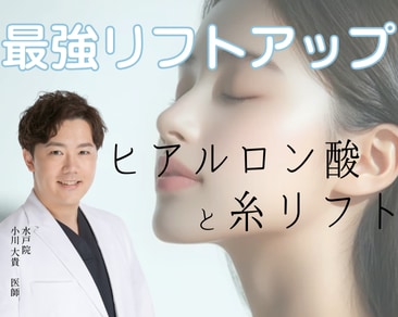【糸リフト×ヒアルロン酸のコラボ｜SBC水戸院  小川医師にお任せ!】最強のリフトアップ効果でたるみ改善